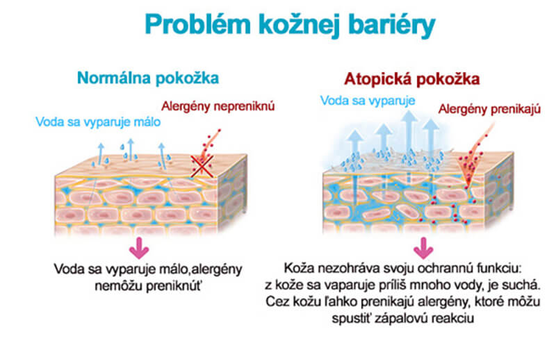 Výhody Omega-3 mastných kyselín pre domáce zvieratá s atopickou dermatitídou sú už roky známe v holistických veterinárnych kruhoch.